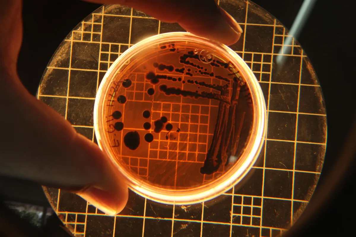 Close-up of bacterial colonies in a Petri dish under a microscope in a lab setting.